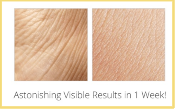Treme’-Anti-Aging-wrinkle before after