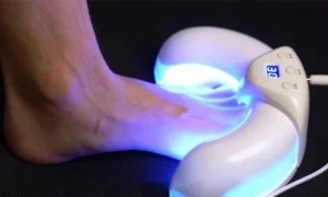 Welnax BioClear Toenail Fungus Device (How Can Use That)